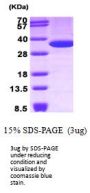 Human Annexin V Recombinant Protein
