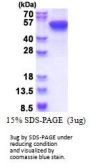 Human KRT16 Recombinant Protein