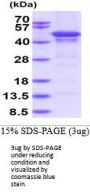 Human MMP-10 Recombinant Protein