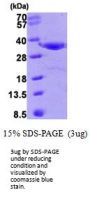 Human Annexin A4 Recombinant Protein