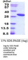 Human HO-1/HMOX1/HSP32 Recombinant Protein