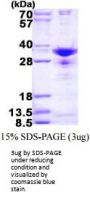Human SNRPA1 Recombinant Protein