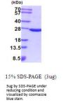 Mouse SOD2/Mn-SOD Recombinant Protein