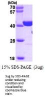Human PARP Recombinant Protein