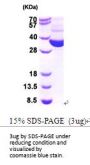 e.coli TRXB Recombinant Protein