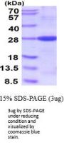 Human Bcl-2 Recombinant Protein