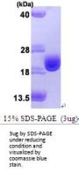 Human Thioredoxin-1 Recombinant Protein