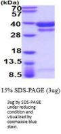 Mouse Cathepsin B Recombinant Protein