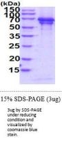 Human Chromogranin A Recombinant Protein