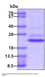 Mouse IL-1 beta /IL-1F2 Recombinant Protein