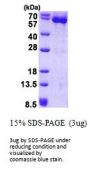 Human HSP60 Recombinant Protein