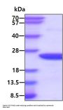Human MYL2 Recombinant Protein