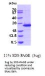 Mouse Lipocalin-2/NGAL Recombinant Protein