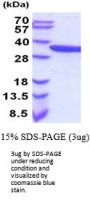 Human alpha -Actinin 1 Recombinant Protein