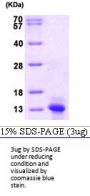 Human CCL2/MCP-1 Recombinant Protein
