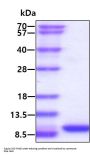 Human CCL5/RANTES Recombinant Protein