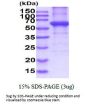 Human KRT5 Recombinant Protein