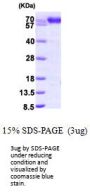 Human PDIA4 Recombinant Protein