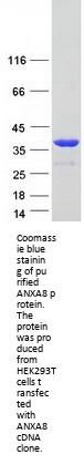 Annexin VIII (ANXA8) (NM_001040084) Human Recombinant Protein
