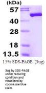 Human Enolase 3/Muscle-specific enolase Recombinant Protein