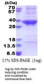 Human CTSE Recombinant Protein