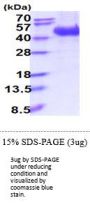Human L-Selectin/CD62L Recombinant Protein