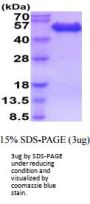 Human CD99 Recombinant Protein