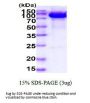 Human MMP9 Recombinant Protein