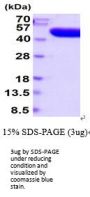 Human Prostatic Acid Phosphatase/ACPP Recombinant Protein
