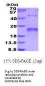 Human VEGF 165 Recombinant Protein