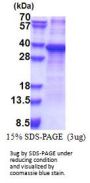 Human RPS2 Recombinant Protein