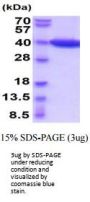 Mouse L-lactate dehydrogenase B chain/Ldhb Recombinant Protein