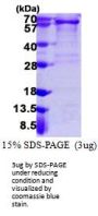 Human PDGF R alpha Recombinant Protein