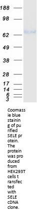 CD62E (SELE) (NM_000450) Human Recombinant Protein