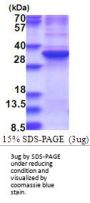Human ZNF32 Recombinant Protein