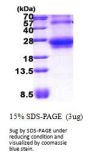 Human RHOQ Recombinant Protein