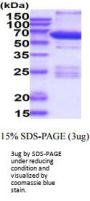 Human PKA C alpha Recombinant Protein