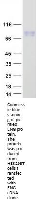 CD105 (ENG) (NM_000118) Human Recombinant Protein