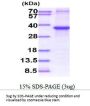Human IGFBP-3 Recombinant Protein