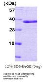Human PTP1B Recombinant Protein