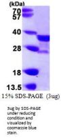 Human NAT1 Recombinant Protein