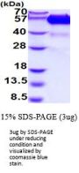Human TNF RI/TNFRSF1A Recombinant Protein