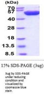 Human PD-ECGF/Thymidine Phosphorylase/TYMP Recombinant Protein