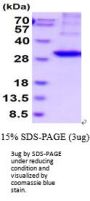 Human Kallikrein 2 Recombinant Protein