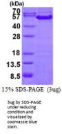 Human Cyclin A2 Recombinant Protein