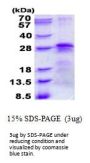 Human BTF3 Recombinant Protein