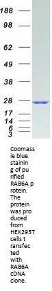 RAB6A (NM_002869) Human Recombinant Protein