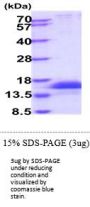 Human CD247 Recombinant Protein