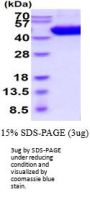 Mouse IL-5 R alpha Recombinant Protein