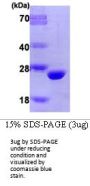 Human COMT Recombinant Protein